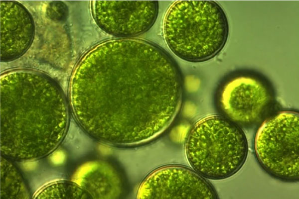 Hình tảo được phóng to dưới kính hiển vi